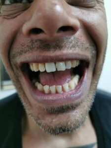 טיפול מקצועי עם ד"ר מיקי ברנשטיין